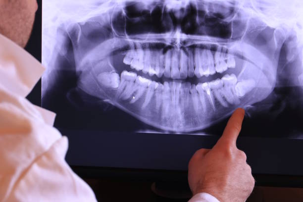 Best Pediatric Emergency Dentist in Weyers Cave, VA