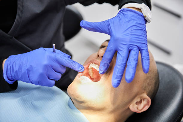 Best Emergency Tooth Extraction in Weyers Cave, VA